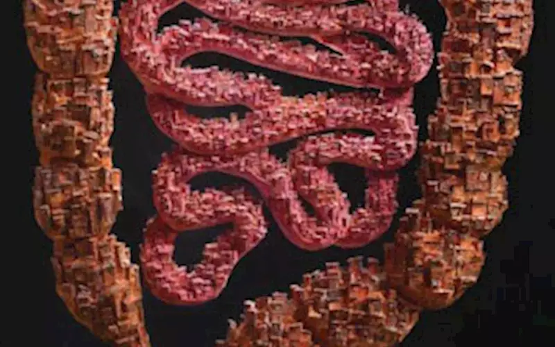 Zentel - Slums (Housing Colonies) for Worms by Medulla Healthcare Communications  |  While every other Indian suffers from worm infestation, most choose to ignore it. This was the challenge facing Zentel from GSK. To draw attention, Medulla decided to make people visualise worms in human intestines. A 10-foot installation of a ‘slum colony’ was created in the shape of an intestine involving 20 artists over three months. Miniature houses of 1 to 5 cm made up the slum, replete with the typical antennae, windows, et al. These were then converted into posters and print.